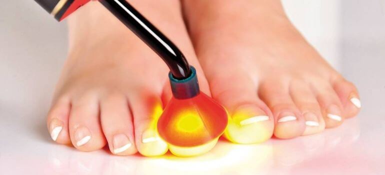 Best UV Light for Nail Fungus