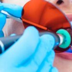 Best Dental Curing Lights: Illuminating the Path to Perfect Cures