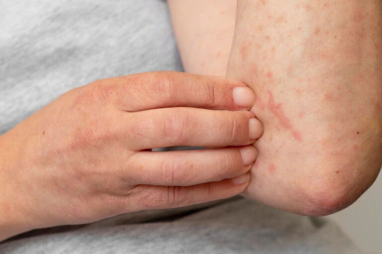 Understanding Bath and Body Works Lotions Shelf Life and Expiry