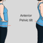 Understanding Anterior Pelvic Tilt